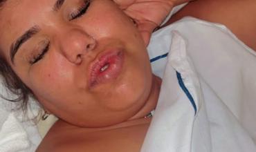 Camilota genera controversia en redes sociales con una publicación desde la clínica