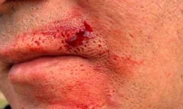 Córdoba: Policía de la caminera de Córdoba fue agredido durante un procedimiento