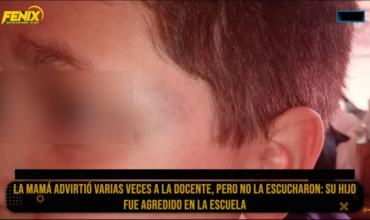 Mamá denuncia agresión a su hijo en la escuela y denunció que la directora no la atendió por el acto del Día del Maestro