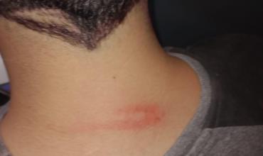 Barrio Nueva Rioja: denuncian que padre le pegó a su hijo de 17 años con una ojota