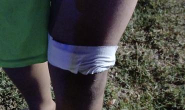 Incidente entre menores en el Parque de la Familia Norte