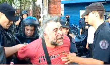 La Policía Federal inició actuaciones administrativas para aclarar la agresión al fotógrafo de A24