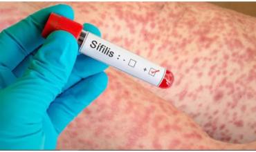 Judith Díaz Bazán: “Hay un crecimiento mundial de las infecciones de transmisión sexual”