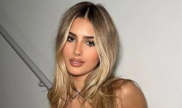 Julieta Poggio presumió su nuevo retoque estético y sus seguidores la fulminaron