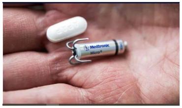 Dr. José Sebastián Schanz, cardiólogo, sobre el primer implante de marcapasos sin cables: “Es la tecnología hacia donde va la medicina”