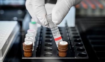 Qué es el hantavirus y por qué preocupa tanto la cepa andina detectada en el crucero que salió de la Argentina