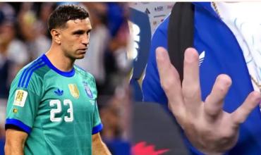 Dibu Martínez mostró cómo tiene el dedo fracturado y reveló que atajará sin férula ante Cabo Verde