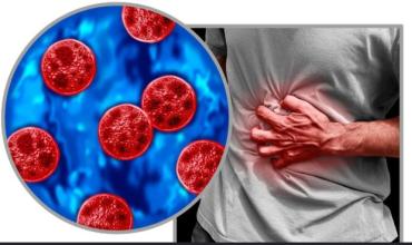 Ciclosporiasis: cómo prevenir la enfermedad parasitaria que se transmite por alimentos y agua contaminados