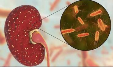Alerta por el síndrome urémico hemolítico: las claves para proteger a los menores