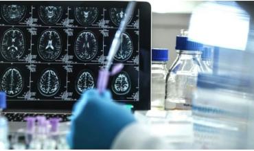 El Alzheimer podría detectarse hasta 20 años antes de los síntomas: cómo es el nuevo análisis