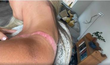 Quemaduras en la piel por un top de Shein: con qué prendas hay que tener cuidado