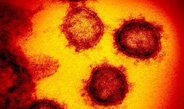 Revelan la aparición de nuevo virus en Kazajistán más mortal que el coronavirus y que ya mató a 1700 personas