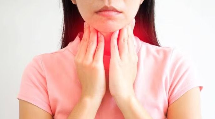 Strep throat cases on the rise, they warn people to watch out for the symptoms