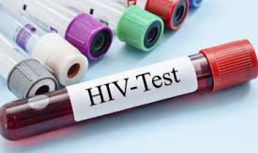 Impulsan la detección del VIH con pruebas rápidas, confiables y discretas en Argentina
