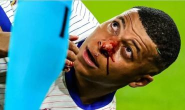 Mbappé será operado de la fractura en el tabique que sufrió en el triunfo de Francia ante Austria por la Eurocopa