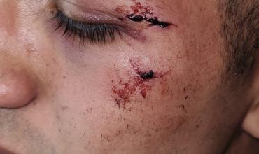 Capital: Un joven sufrió una fuerte agresión por parte de la policía 
