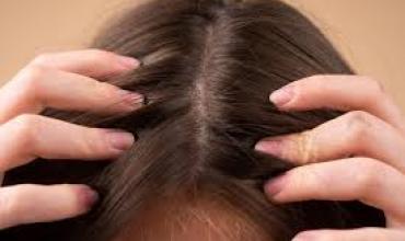 ¿Problemas con la caída de pelo?: el remedio casero para solucionarlo