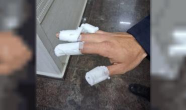 Tres adolescentes quemaron a un policía con una bomba molotov y fueron detenidos en Córdoba