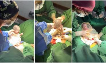 Un caso que sucede cada un millón: nacieron trigemelas en Salta
