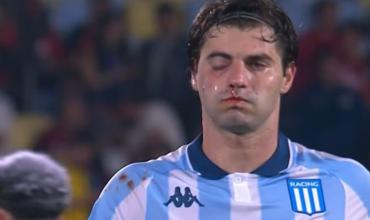 Sosa sufrió una fractura en la cara tras el golpe involuntario de Rojo en la semifinal con Flamengo