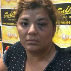 La esposa de Sánchez denunció a Díaz Brizuela y mostró las heridas 