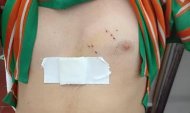 Un joven ingresó herido al Centro de Salud San Vicente y fue derivado al hospital