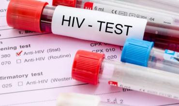 Día mundial del VIH: por qué los contagios no bajan a pesar de los nuevos métodos de prevención