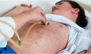 Reportan un caso de sarampión en Entre Ríos y se reactiva la alerta sanitaria nacional