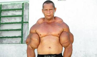Murió “Popeye”, el fisicoculturista brasileño que se inyectaba aceite para tener unos bíceps de 73 centímetros