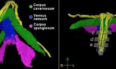 Científicas mapean por primera vez la red de nervios del clítoris en 3D: qué descubrieron
