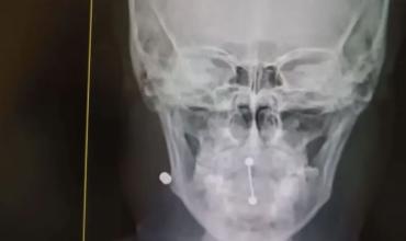 Detuvieron a dos estudiantes por disparar con un rifle de aire comprimido desde un departamento en Córdoba