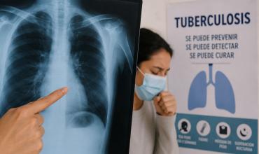 Pese al aumento nacional, La Rioja mantiene bajos índices de tuberculosis