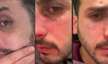 “¿Otra vez te pegó?”: revelaron chats y fotos sobre las presuntas agresiones que habría sufrido el joven asesinado en Chaco