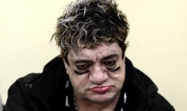 Ordenaron la internación psiquiátrica forzosa de Pity Álvarez tras su fuga frustrada del Hospital Tornú