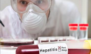 Hepatitis aguda infantil: qué se sabe de la infección de origen desconocido en América Latina